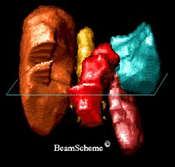 Photograph of robotic surgery.