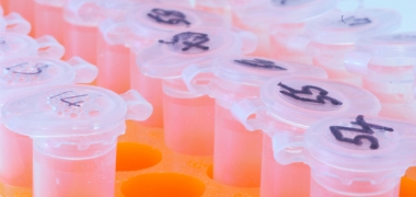 Samples in the lab