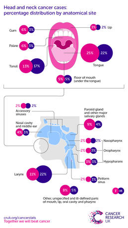 infographic for head and neck cancer cases distributed by anatomical site