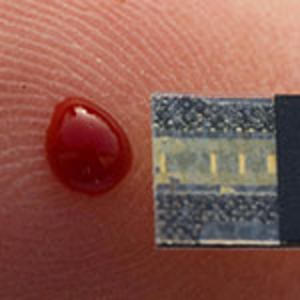 A drop of blood being taken for a blood test