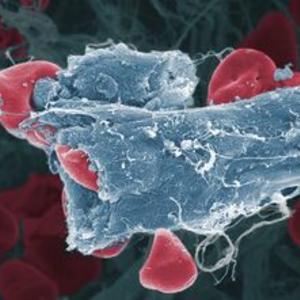 Some blood cells as seen under an electron microscope