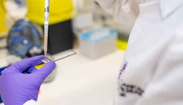 Dropping sample on microscope slide