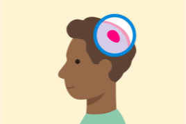 Illustration of a child with a brain tumour inside his head