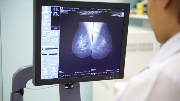 breast scan