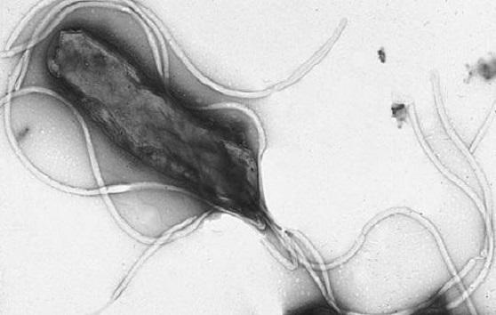 Microscope image of h. pylori bacterium