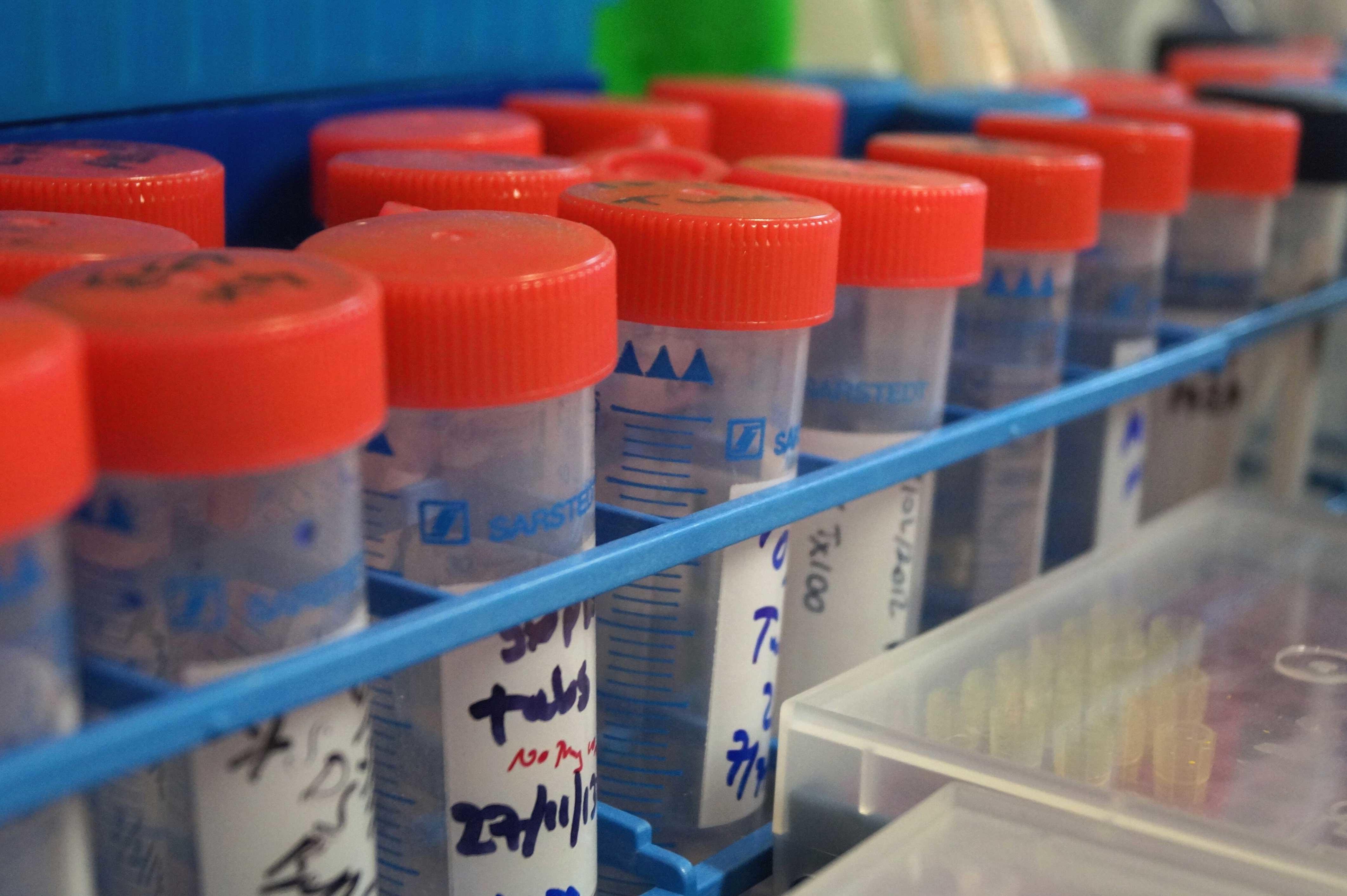 A set of test tubes in a rack in a lab