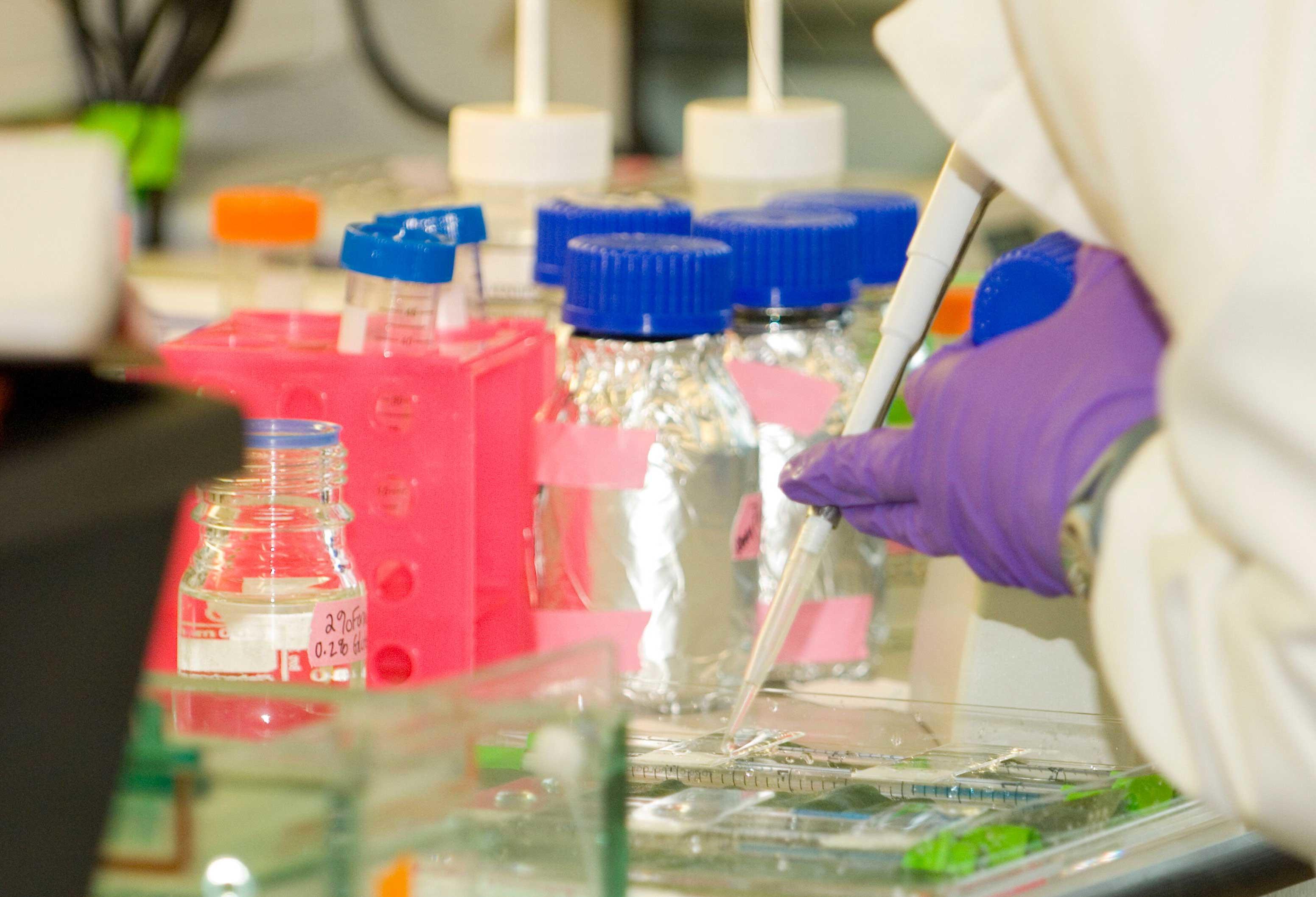 A researcher using a pipette during an experiment in the lab