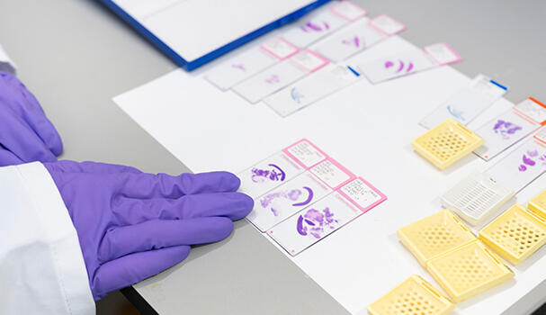 Researchers studying microscope slides in the lab