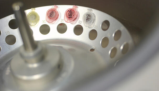 inside of a centrifuge