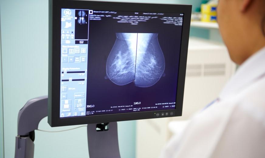 Researcher looking at a mammogram