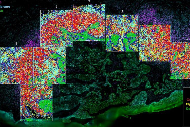 Spatial transcriptomics